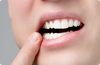 最も歯を失う原因のひとつとされているのが、歯周病です。